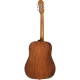 Epiphone DR-100 Songmaker Akustik Gitar Seti (Natural) 4