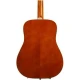 Epiphone Dove Studio - Solid Top Fishman Sonitone Elektro Akustik Gitar (Violin Burst) 2
