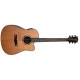 Merida A-17DCES Alcazaba Elektro Akustik Gitarlar 2