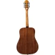 Epiphone DR-100 Akustik Gitar (Vintage Sunburst) 3
