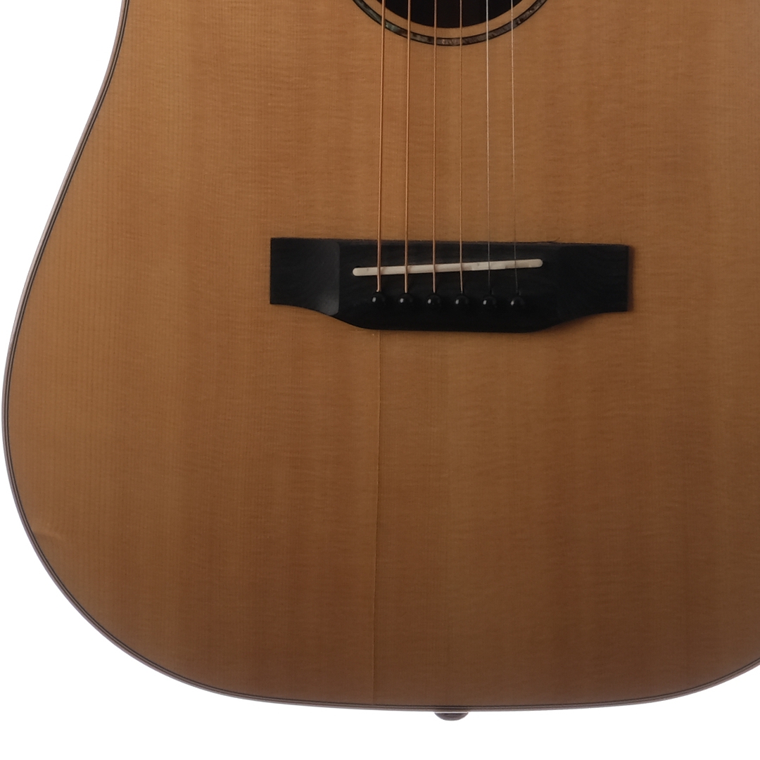 [Outlet] Fenix FT-3ENA Elektro Akustik Gitar (OL 23-23022) 3